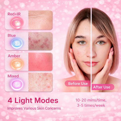 7-Color LED PDT Light Therapy Mask – Silicone Facial Skin Rejuvenation