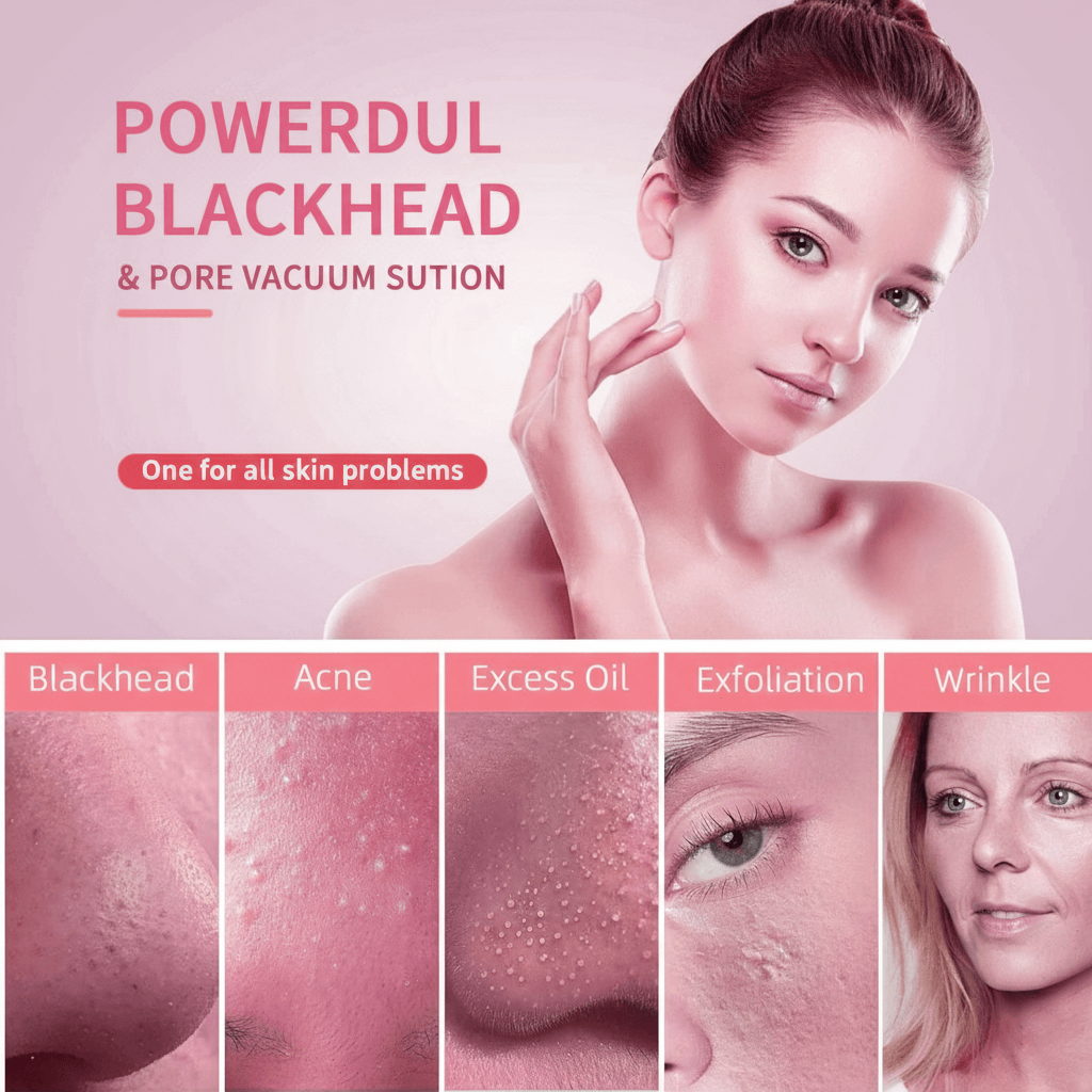 Vacuum Blackhead Remover – Suction Device, Pore Cleaner & Facial Skin Extractor Tool